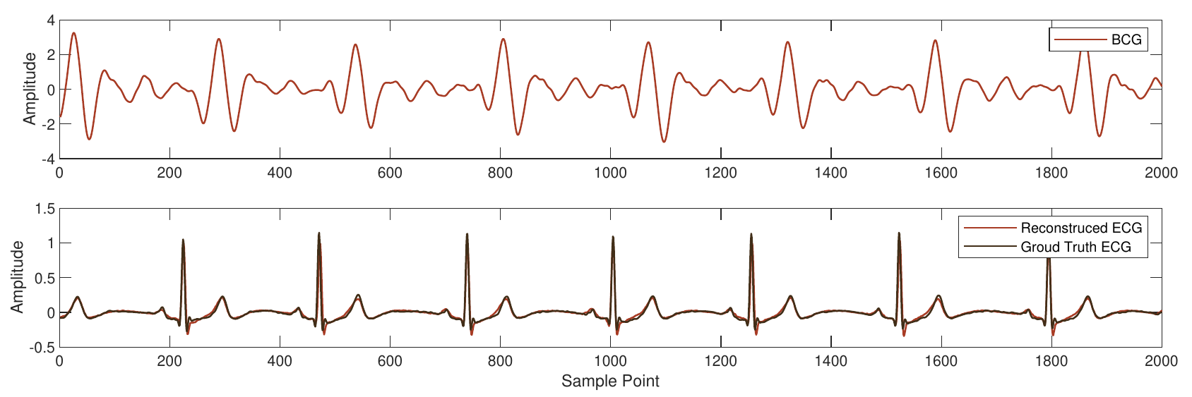 Sample result of BCG-to-ECG reconstruction