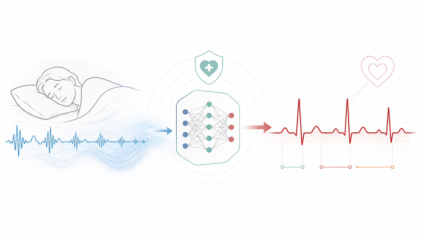 Minimal Med2ECG concept illustration showing sleep BCG transformed into ECG