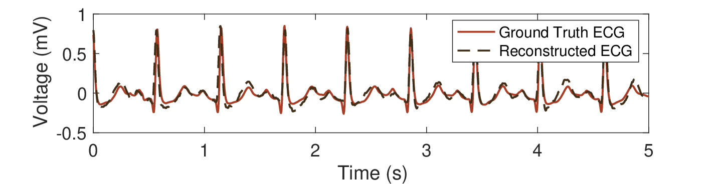 Med2ECG sample result for tachycardia patient data